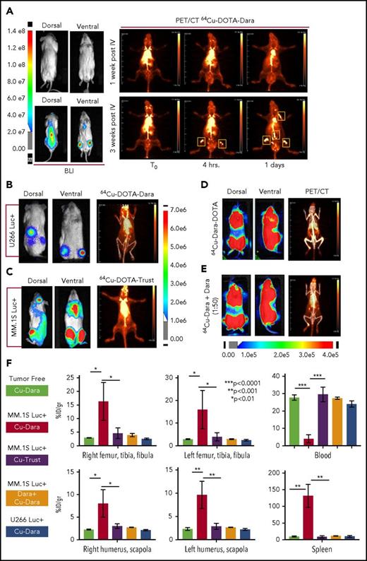 Figure 1. 64Cu-DOTA-Dara detects MM cell dissemination in vivo. (A) The radiolabeled antibody 64Cu-DOTA-Dara (3.7 MBq, 10 µg) was administered to 3 mice that had been transplanted by IV injection with a human MM cell line (MM.1S GFP+/Luc+) before (7 days post-IV) and after (21 days post-IV) signs of MM bone metastasis as detected by BLI. The mice were also imaged with 64Cu-DOTA-Dara radiolabeled antibody on the following days, and PET imaging identified MM cell dissemination in the bone (yellow boxes), which overlap with the BLI signals in the same mouse. (B) 64Cu-DOTA-Dara (3.7 MBq, 10 µg) was also administered to 2 mice that had been transplanted by IV injection with U266 Luc+ MM cells, when clear signs (5 weeks post-IV) of MM bone engraftment were detected by BLI. The mice were imaged with 64Cu-DOTA-Dara radiolabeled antibody after 1 day from the radiolabeled Dara injection (see also supplemental Figure 4B). Of note, no sign of engraftment was observed by PET/CT scan. (C) 64Cu-DOTA-trastuzumab (64Cu-DOTA-trast) (3.7 MBq, 10 µg) was administrated to 3 MM.1S GFP+/Luc+–engrafted mice, as assessed by BLI imaging, and a PET/CT scan was performed 1 day after 64Cu-DOTA-trast injection. No bone signals were observed, but only high background associated with the circulating radiolabeled antibody. (D-E) Mice bearing CD38+ MM cells (MM.1S GFP+/Luc+) with a high level of engraftment (see also supplemental Figure 4C), as assessed by BLI images, that were injected with 64Cu-DOTA-Dara (3.7 MBq, 10 µg) without (D) and with (E) unlabeled Dara (500 µg) and imaged at day 1 by PET/CT. Almost no signs of engraftments were detected in the presence of cold Dara, independent of the BLI signals. (F) 64Cu-DOTA-Dara PET/CT-positive mice (MM.1S GFP+/Luc+–engrafted mice: 4) and negative mice (tumor free mice: 4); 64Cu-DOTA-trast–treated mice (3); unlabeled Dara (Block) treated mice (2); and U266-engrafted mice (2) were sacrificed, and organs were harvested at 24 hours and used for γ counting to determine their radioactive content, as is presented in the bar graphs as a percentage of the injected dose per gram (%ID/g). See also supplemental Figure 5A.