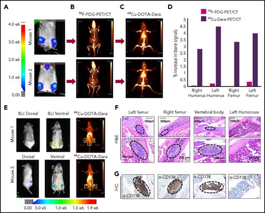 Figure 2. 64Cu-DOTA-Dara PET/CT shows higher resolution than does 18F-FDG-PET/CT. (A-C) Representative images of 2 NSG mice (mouse 1 and mouse 2), which were injected with 5 × 106 MM.1S GFP+/Luc+ cells. After 2 weeks from the injection, the mice were imaged using BLI (A), and after 24 hours, the same mice were imaged by 18F-FDG-PET (B). The day after, 64Cu-DOTA-Dara (3.7 MBq, 10 µg) was administered to the same mice imaged with 18F-FDG-PET and BLI (C). (D) Graphical representation of the intensity of the signal of 64Cu-DOTA-Dara PET/CT in comparison with 18F-FDG-PET/CT, expressed as a percentage of the increase in percentage of the injected dose per gram (%ID/gr) of bone organs in comparison with the nonspecific signal of each radio nucleotide (%ID/gr) detected in the heart. A radiolabeled antibody identified MM cancer cells, which were undetectable by 18F-FDG-PET scan. (E) Mice with minimum BLI signals were IV-injected with 64Cu-DOTA-Dara (3.7 MBq, 10 µg) and then imaged by PET/CT, which identified MM cell dissemination in the bone (yellow boxes). (F-G) Representative images at different magnifications of tissue sections stained by hematoxylin and eosin stain (F) and CD138 immunohistochemical stain (G) showing MM cell accumulation (black dashed ovals) in the left and right femurs and in the vertebral body (lower lumbar), but not in the left humerus, which did not show PET/CT signals. H&E, hematoxylin and eosin; IHC, immunohistochemical.