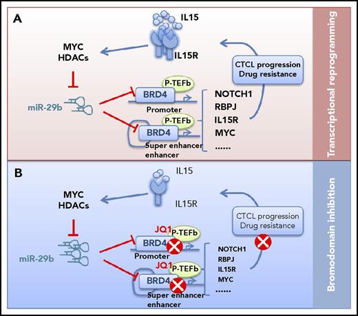A novel oncogenic pathway and potential targets for CTCL. (A) IL-15 represses miR-29b levels through recruitment of Myc/Hdac-1 at the miR-29b regulatory region in CTCL cells. The decreased miR-29b releases its negative regulation on BRD4, which then binds acetylated lysine residues on chromatin at promoter and superenhancer of oncogenic genes. BRD4 regulates tumor driver genes such as NOTCH1, MYC, and RBPJ, coordinates transcriptional reprogramming, and promotes CTCL progression and drug resistance. (B) Bromodomain inhibition (via JQ1) can block dynamic transcriptional responses, remodeling the enhancers and key signaling outputs required for CTCL to progress.