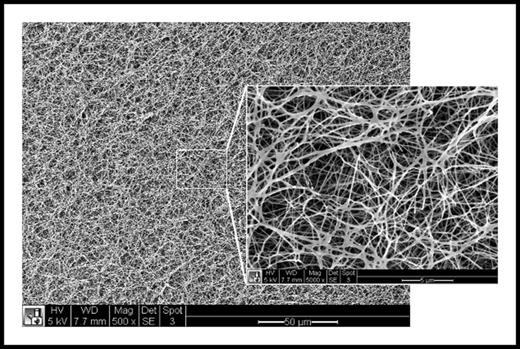 Scanning electron micrograph of the surface of a fibrin clot at ×500 magnification and ×5000 magnification (inset) revealing complex fibrin network architecture at multiple length scales. White scale bar = 50 μm (inset = 5 μm).