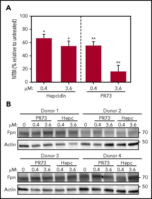 Figure 7. Hepcidin blocks iron export from human RBCs without degrading Fpn. Human PRBCs from 4 different donors were treated with hepcidin or PR73 for 24 hours at 37°C. (A) Iron export from PRBCs was assessed by measuring NTBI in the medium. For the statistical analysis, the 2-tailed 1-sample Student t test was used with 100% as the comparison. (B) Western blotting of Fpn and actin levels in PBRCs.