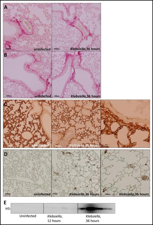 Figure 1. Expression of platelet GPVI and CLEC2 ligands in the lung before and after induction of pneumonia. Mice were infected with K pneumoniae via the airways and sacrificed at the time point indicated; uninfected mice served as controls. (A-B) Picrosirius red staining of lung sections shows collagen underneath the vascular endothelium (A) and bronchial epithelial cells (B). (C) Podoplanin staining of lung sections. (D) Fibrin staining of lung sections. (E) Histone 3 levels in the BALF determined by western blot (n = 4 per group). Histology slides are representative of 4 mice per group.
