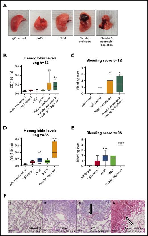 Figure 6. Vascular integrity during pneumosepsis partly depends on platelet GPVI, but CLEC 2 or neutrophils are not crucially involved. Mice were injected with JAQ1, INU-1, or IgG control antibody or platelet-depleting antibody with or without depletion of neutrophils, infected with K pneumoniae via the airways, and sacrificed after 12, 36, or 42 hours after infection. (A-F) Panels show lung bleeding. (A) Representative photographs of infected lungs. Lung bleeding early after infection (t = 12; B-C) or at late-stage pneumosepsis (t = 36; D-F). (B,D) Hemoglobin was measured in 50-fold-diluted lung homogenates by light density at 410 nm optical density (OD). (C,E) Lung bleeding was scored on hematoxylin and eosin–stained tissue sections by a pathologist blinded for groups. (F) Representative photomicrographs of hematoxylin and eosin–stained lung sections of uninfected and infected mice at 36 hours. (i-iv) 40× enlarged pictures of uninfected mice receiving IgG control (i), 36-hour-infected IgG control (ii), JAQ1-treated mice (iii), or mice with a <1% platelet count due to aGPIb antibody (iv). Bleeding is indicated by an arrow. Data are presented as box and whisker plots of 8 mice per group at each time point. In panel E, all platelet-depleted mice had the maximal bleeding score (4). *P < .05, **P < .005, ***P < .0005, and ****P < .00005 vs IgG control.