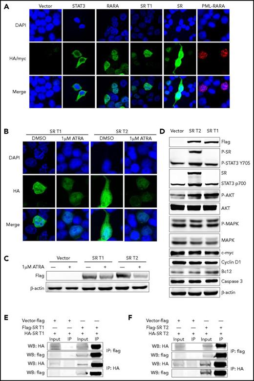 Figure 2. Cellular location and homodimerization analyses of STAT3-RARA (SR) fusion protein. (A) Immunofluorescence analysis of 293T cells transfected with pcDNA3.1 expression plasmids of vehicle (vector), hemagglutinin (HA)-tagged STAT3, HA-tagged RARA, HA-tagged SR, and MYC-PML-RARA, respectively. HA antibody was used as primary antibody, and 4′,6-diamidino-2-phenylindole (DAPI) was used for nuclear staining. (B) ATRA downregulates SR protein expression. After transfection with pcDNA3.1 HA-tagged SR, 293T cells were treated with 1 μM of ATRA or dimethyl sulfoxide (DMSO; vehicle control) for 48 hours. The tagged protein was detected using an anti-HA antibody followed by an Alexa Fluor 488–conjugated secondary antibody. DAPI was used for nuclear staining. (C) Viral-transfected 293T cells were treated with 1 μM of ATRA or DMSO (vehicle control) for 48 hours before western blot. The tagged protein was detected using an antiflag antibody, and β-actin served as the loading control. (D) Empty-vector, flag-tagged SR T1 and T2 were expressed in 293T cells. Immunoblotting analysis of expression of flag-tagged fusions, STAT3, phosphorylated (P) STAT3, AKT, P-AKT, MAPK, P-MAPK, BCL2, c-MYC, cyclin D1, and caspase 3 was performed in 293T cell. Protein level of STAT3 targets with SR expression. (E-F) Homodimerization of SR fusions were detected by coimmunoprecipitation. Both HA-tagged SR T1 (E) and HA-tagged SR T2 (F) can be immunoprecipitated by flag antibody and vice versa. IP, immunoprecipitation.