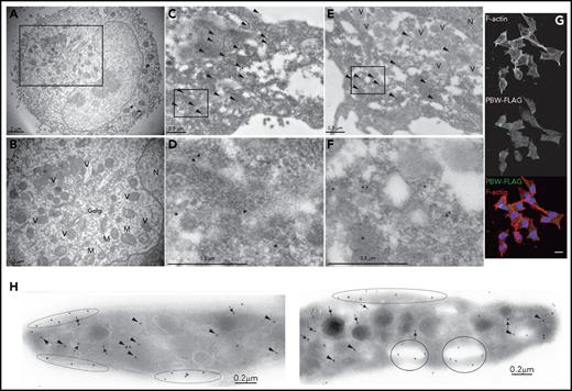 Figure 4. Subcellular localization of PBW-FTAP and Nbeal2. (A) Ultrastructure of PBW-FTAP in CHRFs by transmission electron microscopy (TEM). (B) High magnification of the area squared in panel A showing intracellular vesicles (V), mitochondria (M), Golgi, and the nucleus (N). (C) Indirect gold-labeling of PBW-FTAP using anti-FLAG. Arrowheads point to clusters of gold across the cytoplasm of CHRFs. (D) High magnification of the boxed area in panel C. (E) PBW-FTAP in CHRFs stained as in panel C showing gold clusters in the cytoplasm but not in the intracellular vesicles. (F) High magnification of the boxed area in panel E. (G) Labeling of F-actin filaments with Phalloidin (top panel), PBW-FTAP (middle panel), and overlay (bottom panel) of the results from top and middle panels, visualized by confocal microscopy; nucleus stained with DAPI. Scale bar (which applies to all subpanels in panel G) represents 10 μm. (H) Gold-labeling of Nbeal2 in human platelets with rabbit antiserum. Gold particles label the platelet cytoplasm (arrowheads), α-granules (arrows), OCS (circles), and periphery (flat ellipses). Images are representative of the results of 2 TEM, 1 (gold-labeling), and 3 (confocal microscopy) independent experiments.