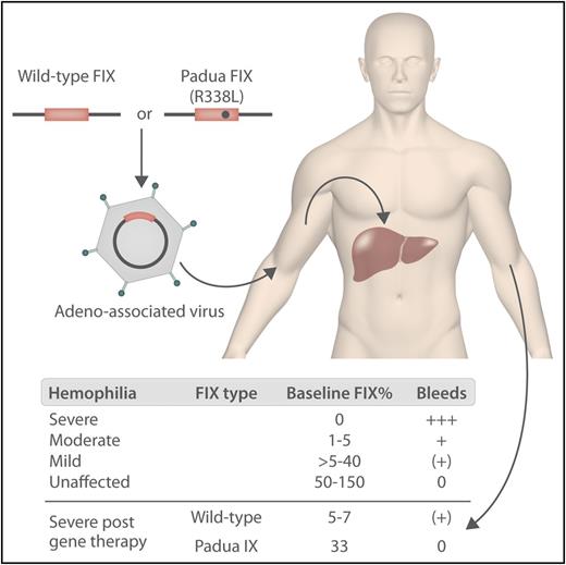 In hemophilia B gene therapy, either wild-type or Padua factor IX with a liver-specific promoter is inserted into the genome of the AAV vector and administered via a peripheral vein. The vector transduces hepatocytes, leading to the production of FIX. The levels of FIX in patients and unaffected individuals before and after gene therapy are shown below. Professional illustration by Somersault18:24.
