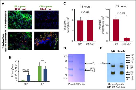 Figure 2. Deposition of EP and CEP in normal and inflamed peritoneal tissues. Peritoneal tissues were isolated from mice at 72 hours after thioglycollate-induced inflammation (A, lower panels) or from nontreated mice as a control (A, upper panels). Immunofluorescent staining demonstrates EP or CEP (green fluorescence) and CD68 (red fluorescence). Magnifications ×200. (B) CEP and EP staining in noninflamed (green bars) and inflamed (blue bars) tissues were analyzed using Fiji software. (C) Neutrophil and macrophage accumulation in the peritoneal cavity during thioglycollate-induced peritoneal inflammation after anti-CEP mAb treatment. Mice were injected twice with anti-CEP mAb or IgM control (30 minutes before and 24 hours after injection of 1 mL of 4% thioglycollate). Neutrophils were isolated at 18 hours and macrophages were isolated at 72 hours after thioglycollate injection. Statistical analysis was performed using Student t test. (D) Immunoprecipitation with anti-CEP mAb. Mouse peritoneal exudate was isolated at 72 hours after injection of thioglycollate and incubated with anti-CEP antibody. Antibody-bound fraction was separated by Laemmli SDS gradient electrophoresis (4% -15%). Fg was detected by mass spectrometry in the major bands isolated by immunoprecipitation with anti-CEP mAb. (E) Western blot analysis with anti-CEP pAb after immunoprecipitation with anti-Fg mAb. The same peritoneal exudate was immunoprecipitated with anti-Fg polyclonal antibody and the isolated fraction was analyzed by western blot with anti-CEP polyclonal antibody. Fg, fibrinogen; IP, immunoprecipitation; mAb, monoclonal antibody; n/s, not significant; pAb, polyclonal antibody; WB, western blotting.