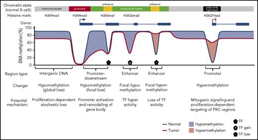 Figure 1. Illustration of DNA methylation alterations observed in B-cell malignancies. Several types of tumor-specific changes have been observed in genome-wide DNA methylation studies and are commonly associated with chromatin states in normal B cells. Global hypomethylation is enriched in intergenic regions associated with heterochromatin and quiescent chromatin states. Additional targeted hypomethylation occurs across the methylome of malignant B cells, which is enriched in active gene bodies and the binding sites of overexpressed transcription factors (TFs) and in regions immediately downstream of promoters. Hypermethylation of enhancer regions resulting in enhancer decommissioning is also enriched in gene bodies and correlates with loss of TF expression. Finally, all B-cell malignancies demonstrate hypermethylation of promoters and other sequences associated with polycomb repression in precursory normal cells.