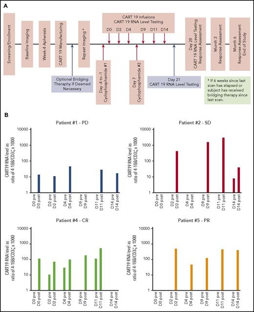 Figure 1. Study design and CART19 RNA persistence. (A) Study schema. (B) CART19 RNA levels in peripheral blood. These were measured on each infusion day pre- and postinfusion and expressed as normalized ratio of 4-1BB/CD3ζ gene transcript copies by reverse transcription polymerase chain reaction and multiplied by a factor of 1000. Patient 1, who experienced progressive disease (PD), had the lowest CART19 RNA levels, and no CART19 RNA was detected in preinfusion samples. This was in contrast to patient 4, who achieved complete response (CR). He had CART19 RNA detected in 3 of 5 preinfusion samples, reflecting persistence for at least 48 hours from previous infusion on those days. PR, partial response; SD, stable disease.