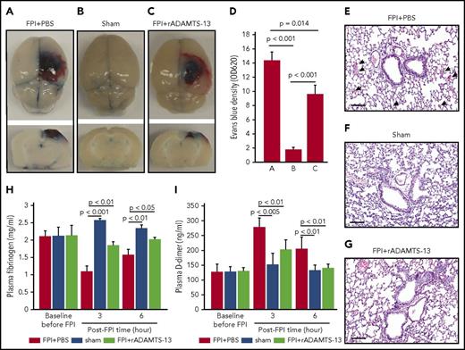 Figure 1. rADAMTS-13-preconditioning reduced FPI-induced vascular leakage and coagulopathy. (A-C) Topical and coronal views of the brains of C57BL/6J mice preconditioned with a single dose (200 μg/kg) of rADAMTS-13 or an equal volume of PBS before being subjected to 1.9 atm of FPI. Control mice received PBS and underwent sham surgery (representative images from 27 independent experiments). The top panels show surface areas of the impact site, and the coronal views show a depth of injury that is indicative of secondary injury. The reduction of vascular leakage is more visible in the coronal views. (D) Evans blue dye released from vessels into the interstitial space of the brain was measured in brain homogenates (n = 27; 1-way ANOVA). (E-G) Representative hematoxylin and eosin-stained lungs from mice that received the 3 treatments (arrow: microvascular bleeds; bar = 100 μm). Plasma levels of fibrinogen (H) and D-dimer (I) from mice in the above treatment groups (n = 27; 1-way ANOVA).