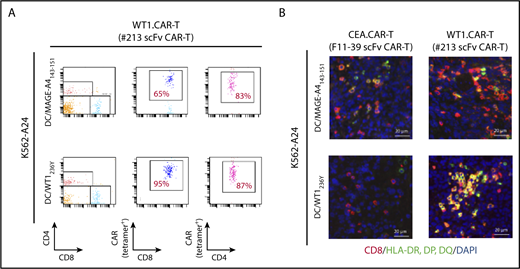Figure 7. Antigen-specific DC vaccination enhanced #213 scFv CAR-T cells accumulation in periphery and activation in tumor tissues. Three-day K562-A24 bearing NOG mice were transferred with #213 scFv CAR-T cells or CEA-specific (F11-39 scFv) CAR-T cells (1 × 107 cells) followed by vaccination with DCs (1 × 105 cells) pulsed with WT1236Y or MAGE-A4143-151 as Figure 6. On day 16, PBMCs and tumor tissues were harvested and subjected to FACS (A) and immunohistochemical (B) analysis, respectively. A representative result from 2 independent experiments is shown.