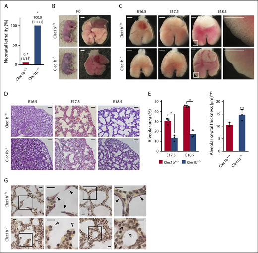 Figure 1. Morphological and histological abnormalities in Clec1b-deficient lung. (A) Neonatal lethality of Clec1b+/+ and Clec1b−/− mice. Numbers within parentheses: dead/total neonates at P0. *P = .0000, Fisher’s exact test. (B) Cyanotic appearance of whole-body and lung air inflation failure in Clec1b−/− neonates. (C) Ventral views of E16.5/E17.5/E18.5 fetal lungs; magnified views of framed areas in images are shown on the right. (D) Hematoxylin and eosin staining of E16.5/E17.5/E18.5 lung sections. (E-F) Quantification of alveolar area (E) and alveolar septum thickness (F); mean ± SD, n = 3 each. *P = .0023; **P = .0003; ***P= .0414, Student t test. (G) Elastica van Gieson staining of P0 lung sections. Magnified views of framed areas in images are shown on the right. Black and open arrowheads: mature elastic fibers (dark purple) and alveolar septa without elastic fibers, respectively. Scale bars: 1 mm (B-C); 25 μm (D); 10 μm (G).