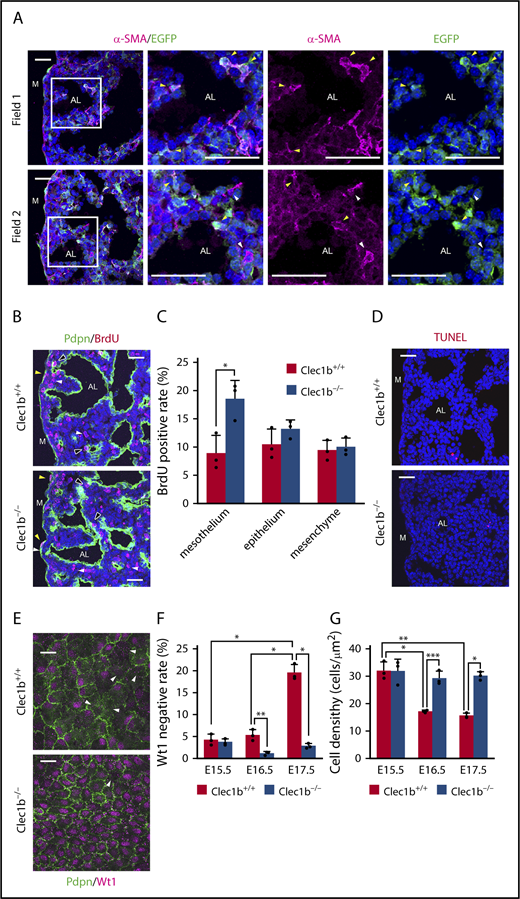 Figure 3. Clec1b deficiency causes lung mesothelial cell hyperproliferation and abnormal differentiation. (A) Lineage tracing of adMYFs in E17.5 Wt1-EGFPCre, CAG-CAT-EGFP lung sections by α-SMA (magenta) and EGFP (green) staining and DAPI (blue) counterstaining; magnified views of framed areas in images are shown on the right. Arrowheads indicate α-SMA+EGFP+ cells (yellow), α-SMA+EGFP− cells (white). (B) Immunostaining of BrdU (red) and Pdpn (green) and DAPI staining (blue) of E17.5 distal lung sections. Pdpn immunostaining distinguishes the mesothelium, epithelium, and mesenchyme, as Pdpn is expressed in luMCs, AECs, and LECs in the distal lung. Arrowheads: BrdU-positive mesothelial cells (yellow), epithelial cells (black), and mesenchymal cells (white). (C) Histogram showing BrdU-positive rates in mesothelial, epithelial, and mesenchymal cells in E17.5 distal lung; mean ± SD, n = 3 each; *P = .0014, Holm-Sidak test. (D) TUNEL (red) and DAPI (blue) staining of E17.5 distal lung sections. TUNEL-positive apoptotic cells were very rare in both Clec1b+/+ and Clec1b−/−. (E) Whole-mount immunohistochemistry of Wt1 (magenta) and Pdpn (green) in E17.5 luMCs. Arrowheads: Wt1-negative luMCs. (F) Quantification of Wt1-negative rate in luMCs at E15.5, E16.5, and E17.5; mean ± SD, n = 3 each. *P < .0001; **P = .0074, Tukey’s test. (G) Quantification of luMC density at E15.5, E16.5, and E17.5; mean ± SD, n = 3 each. *P = .0002; **P < .0001; ***P = .0010, Tukey’s test. AL, alveolar sac; M, lung mesothelium. Scale bars: 25 μm (A-B,D,E).