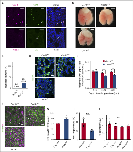 Figure 4. Platelet-specific Clec1b-deficient (Clec1bΔPLT) mice show mild Clec1b−/−-like lung abnormalities. (A) Clec-2 staining (magenta) with CD41 (green, platelets, and megakaryocytes) or Ela2 (green, neutrophils) and DAPI (blue) in E17.5 wild-type lungs. Arrowheads indicate megakaryocytes (white) and neutrophils (black). Clec-2 expression entirely overlapped with CD41 expression, but not with Ela2. (B) Ventral views of Clec1bfl/fl (wild-type), Clec1bΔPLT, and Clec1b−/− fetal lungs at E17.5. (C) Neonatal lethality of Clec1bfl/fl and Clec1bΔPLT neonates. *P = .00127, Fisher’s exact test. (D) Immunostaining of α-SMA (green) and DAPI (blue) in E17.5 distal lung. AL, alveolar sac; M, lung mesothelium. (E) Quantification of α-SMA expression in Clec1bfl/fl and Clec1bΔPLT distal lung at E17.5; mean ± SD, n = 3 each. *P = .0211; **P = .0033, Holm-Sidak test. (F) Whole-mount immunohistochemistry of Wt1 (magenta) and Pdpn (green) in E17.5 luMCs. Arrowheads: Wt1-negative luMCs. (G) Quantification of luMC density; mean ± SD, n = 3 each. *P = .0281, Student t test. (H) Quantification of Wt1-negative rate in luMCs; mean ± SD, n = 3 each. N. S., not significant; P = .062, Student t test. (I) Platelet counts in E17.5 Clec1b+/+, Clec1b−/−, Clec1bfl/fl, and Clec1bΔPLT fetal blood; mean ± SD, n = 6, 6, 3, and 4, respectively. N.S., not significant, Tukey’s test. Scale bars: 25 μm (A,D,F); 1 mm (B).