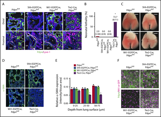 Figure 6. Pdpn on LECs partners with platelet Clec-2 for lung development. (A) Pdpn expression (green) in wild-type and AEC-, luMC-, and LEC-specific Pdpn-deficient lungs (Shh-EGFPCre, Wt1-EGFPCre, and Tie2-Cre, respectively). Lyve-1 (magenta) and DAPI (blue) were co-stained with Pdpn to visualize lymphatic vessels and nuclei. (B) Neonatal lethality in tissue-specific Pdpn-deficient mice. *P = .0000, Fisher’s exact test. (C) Ventral views of E17.5 whole lung. (D) Immunostaining of α-SMA (green) and DAPI (blue) in E17.5 distal lung. (E) Quantification of α-SMA expression in E17.5 distal lung. The asterisk indicates the group in which α-SMA expression was significantly lower than that in the other 3 groups; mean ± SD, n = 3 each. *P < .0001, Holm-Sidak test. (F) Whole-mount immunohistochemistry of Wt1 (magenta) or GFP (magenta) and Pdpn (green) in luMCs. GFP staining was performed only in Wt1-EGFPCre, Pdpnfl/fl luMCs because this strain is heterozygous for the Wt1 gene, and therefore the intensity of Wt1 staining in these mice was indistinct from that in other strains. Pdpn was not detected in Wt1-EGFPCre, Pdpnfl/fl luMCs, as Pdpn was deleted by Wt1-EGFPCre. A, artery; AL, alveolar sac; BR, bronchiole; LV, lymphatic vessel; M, lung mesothelium. Scale bars: 25 μm (A, D, and F); 1 mm (C).