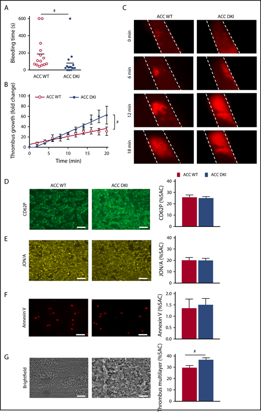 Figure 2. ACC DKI mice display enhanced primary hemostasis and thrombosis. (A) Tail bleeding times of ACC WT and ACC DKI mice in saline at 37°C. Individual values are plotted on the graph (n = 14 in each group). Bars indicate means. #P ≤ .05. Data were analyzed by the Mann-Whitney U test. (B-C) ACC WT and ACC DKI mice were subjected to in vivo FeCl3-induced thrombosis of carotid arteries (10% FeCl3, 5 min). Thrombus formation was monitored by analyzing exogenous carboxyfluorescein succinimidyl ester-labeled platelet accumulation by intravital microscopy and recording videos (fluorescence) of microscopic images every 2 minutes. (B) Thrombus growth kinetics was evaluated by dividing the area of the thrombus at time (t) by the area of the same thrombus at time 0, defined as the time at which the thrombus first reaches 100 µm. Thrombus growth is expressed as means ± SEM per group at different times with fitted regression lines (at least 6 mice/group). Slopes are statistically different on the basis of significant interaction (#P ≤ .05) between slope and group in a linear model, with group, time, and their interaction as covariates. (C) Representative fluorescence microscopy images at 0, 6, 12, and 18 minute after FeCl3 application (original magnification ×10). (D-G) Whole blood from ACC WT and ACC DKI mice was perfused over collagen-coated surfaces (100 µg/mL) at a shear rate of 1000 s−1. Exposure of P-selectin was evaluated by staining with CD62P Ab (D), αIIbβ3 integrin activation by JON/A Ab (E) and phosphatidylserine externalization by Annexin V (F). Thrombus formation was assessed on brightfield images taken 3.5 minutes after initial blood perfusion (G). Representative images appear on the left. Scale bars represent 20 µm. Histograms indicate quantification of surface area covered (SAC) by P-selectin (D), activated αIIbβ3 (E), Annexin V (F)–positive platelets or multilayered platelet thrombi (G). The results are expressed as means ± SEM (at least 4 mice/group). #P ≤ .05. Data were analyzed by the Mann-Whitney U test.