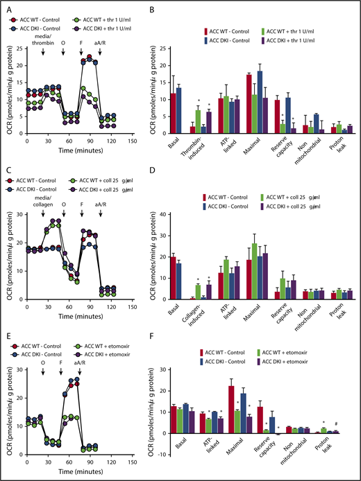Figure 5. Lack of ACC phosphorylation does not affect oxidative metabolism. (A-F) Oxygen consumption rate (OCR) was measured in washed platelets pretreated or not with Etomoxir (25 μM) (E-F) for 1 hour before bioenergetic measurements. OCR was assessed under basal conditions, after injection of media alone or 1 U/mL thrombin (A,B) or 25 μg/mL collagen (C-D) or followed by treatment with 1 μM oligomycin (O), 0.1 μM carbonyl cyanide p-trifluoromethoxyphenylhydrazone (F), and a mix of 1 μM antimycin A (aA) and 1 μM rotenone (R). (A,C,E) Representative OCR profiles with thrombin (A) and collagen stimulation (C) or Etomoxir treatment (E). (B,D) Mitochondrial function was assessed by calculating basal, thrombin-induced (B) or collagen-induced (D), ATP-linked, maximal, nonmitochondrial, reserve capacity and proton leak OCR. In addition, bioenergetics measurements were assessed in Etomoxir-treated platelets (F). The results are expressed as means ± SEM (at least n = 3). *P ≤ .05 relative to respective untreated platelets, #P ≤ .05 between ACC WT and ACC DKI platelets. The data underwent 2-way ANOVA.