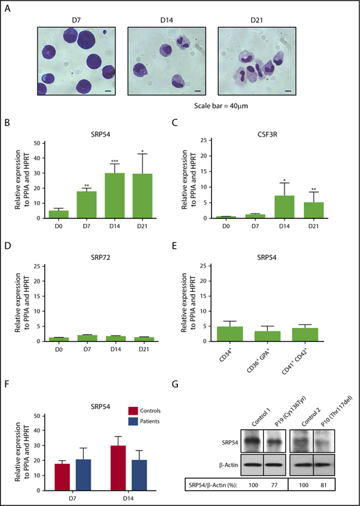 Figure 3. Increased expression of SRP54 during granulocyte differentiation. CD34+ cells from healthy donors (controls) or patients were cultured for 21 days in serum free-medium with SCF, IL-3, and G-CSF. (A) May-Grünwald Giemsa was performed to determine the purity and stages of differentiation at days (D) 7, 14, and 21. The expression levels of (B) SRP54, (C) CSF3R, and (D) SRP72 were quantified by quantitative reverse transcription polymerase chain reaction (qRT-PCR) related to PPIA and HPRT at days (D) 0, 7, 14, 21. Results are the mean ± SEM of 4 to 8 control samples performed in triplicate. Student t test: *P < .05; **P < .01; ***P < .001. (E) The expression level of SRP54 was quantified by qRT-PCR related to PPIA and HPRT in CD34+ progenitors, CD36+GPA+ erythroblasts, and CD41+CD42+ megakaryocytes. Results are the mean ± SEM of 4 to 8 control samples performed in triplicate. (F) The expression level of SRP54 was quantified by qRT-PCR related to PPIA and HPRT in granulocytic precursors at days 7 and 14 in both controls (n = 5) and patients (n = 5). Results are the mean ± SEM performed in triplicate. (G) The expression level of SRP54 protein was evaluated by western blot analysis on day 10 granulocytic precursors in controls (n = 2) and patients (n = 2), using specific antibodies.