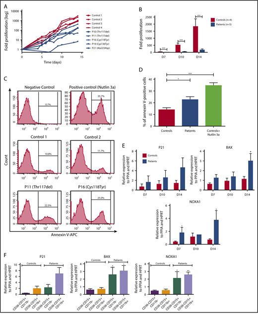 Figure 4. SRP54 mutations induce a great impairment of granulocytic differentiation. CD34+ cells from healthy donors (controls) or patients were cultured for 14-21 days in serum free-medium with SCF, IL-3, and G-CSF. (A) The fold increase in proliferation in log scale was assessed individually by Trypan blue exclusion, using controls (= 4) and patients (n = 5). (B) Fold increase in proliferation in patients and controls at days (D) 7, 10, and 14. Mean ± SEM; ***P < .001. (C) Apoptotic granulocytic cells were analyzed by flow cytometry using Annexin V+ assay in controls (n = 2) and patients (n = 2). The MDM2 antagonist, Nutlin 3a (20 µM for 24 hours), was used as positive control at D9. (D) The results represent the mean of 3 independent experiments at days 7, 9, and 13 with controls (n = 2) and patients (n = 2). Mean ± SEM; *P < .05; ***P < .001. (E) P53 target genes (P21, BAX, NOXA) expression levels were checked by qRT-PCR related to PPIA and HPRT at days (D) 7, 10, and 14 with controls (n = 3-4) and patients (n = 2-4). Mean ± SEM; *P < .05. (F) Granulocytic cells were sorted as CD15+CD11b+CD36− cells between days 10 and 14, using CD36 to specifically eliminate monocytes. P53 target genes (P21, BAX, NOXA) expression levels were checked by qRT-PCR related to PPIA and HPRT with controls (n = 4) and patients (n = 3). Mean ± SEM; *P < .05; **P < .01.
