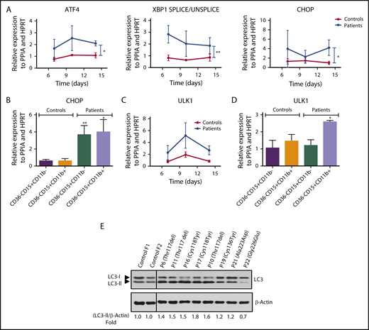 Figure 5. SRP54 mutant induce ER-stress and autophagy. mRNA expression levels of (A) ATF4, CHOP, and spliced XBP1 for ER stress and (B) ULK1 for autophagy were examined by qRT-PCR related to PPIA and HPRT at days (D) 7, 10, and 14 of culture of control (n = 3-4) and patient (n = 2-4) cells. Mean ± SEM; unpaired t test, 2-tailed on controls vs patients combing all days, *P < .05. mRNA expression levels of (C) CHOP and (D) ULK1 were also checked after sorting CD36−CD15+CD11b− and CD15+CD11b+CD36− granulocytic cells between days 10 and 14. Controls (n = 3) and patients (n = 3); mean ± SEM; unpaired t test, 2-tailed on controls vs patients; *P < .05; **P < .01. (E) Using primary fibroblasts, autophagy was evaluated by the lipidation of LC3 (LC3-II) by western blot analysis in controls (n = 2) and SRP54-mutated patients (n = 8). β-Actin was used as a loading control. Fold induction of LC3-II/β-Actin was quantified using Image J software.