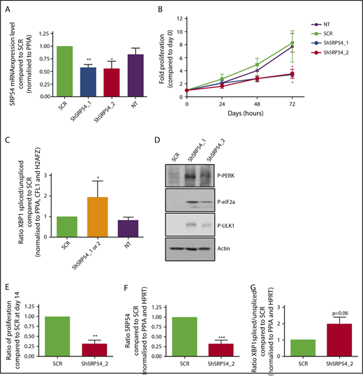 Figure 6. SRP54 knockdown induces a defect in proliferation and increased ER stress and autophagy. (A-D) HL-60 cell lines stably expressing either shRNA targeting SRP54 (1 or 2) or a SCR were generated after transduction with lentiviral particles and after sorting on GFP+ after 72 hours. Nontransduced (NT, not transduced) HL-60 cell line was used as control. (A) SRP54 mRNA expression level was checked by qRT-PCR related to PPIA (n = 4). Mean ± SEM; unpaired t test, 2-tailed; *P < .05; **P < .01. (B) Fold proliferation was assessed after Trypan blue exclusion for 3 days (n = 4). Mean ± SEM; unpaired t test, 2-tailed; *P < .05. (C) Spliced XBP1 mRNA expression level was checked by qRT-PCR related to PPIA, CFL1, and H2AZ (n = 4). Mean of SCR or shRNA_1 and 2 ± SEM; Unpaired t test, 2-tailed; *P < .05. (D) P-eIF2a, P-PERK, P-ULK1 were evaluated by western blot analysis using specific antibodies. β-Actin was used as loading control. (E-G) Normal CD34+ progenitors were transduced with 2 lentiviruses expressing either shRNA targeting SRP54 (ShSRP54_2) or SCR. CD34+GFP+ cells were sorted 72 hours later and were cultured for 10 days in serum-free medium with SCF, IL-3, and G-CSF. (E) Granulocytic cells were counted by Trypan blue exclusion (n = 3) or sorted the same day on the CD36−CD15+CD11b+ phenotype for analysis of (F) SRP54 gene expression level (n = 4) and (G) spliced XBP1 (n = 3) mRNA expression level by qRT-PCR related to PPIA and HPRT. Mean ± SEM; unpaired t test, 2-tailed; **P < .01; ***P < .001.