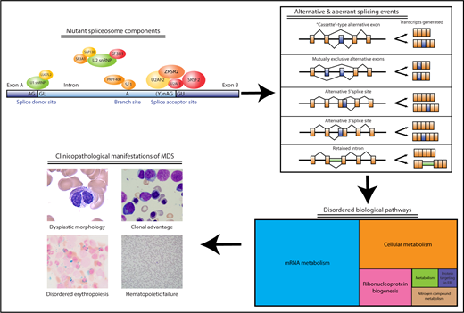 Components of the spliceosome that are recurrently mutated in MDS and their relationship to disease-associated clinicopathological features. Acquired spliceosome mutations, especially in components important for 3′ splice site recognition, are observed in more than one-half of MDS patients, particularly those with ring sideroblasts (SF3B1) or myeloproliferative neoplasm overlap features (SRSF2). The 3 most commonly mutated splicing factors (U2AF1, SRSF2, SF3B1) are depicted in red, whereas other less commonly observed mutations (ZRSR2, SF3A1, U2AF2, PRPF40B, LUC7L2, SF1, SAP130) are depicted in orange-yellow. These mutations result in a wide variety of alternative and aberrant splicing events in CD34+ or more differentiated cells, which can result in reduced, increased, or altered function in encoded proteins important for a broad range of cellular pathways. It is not yet clear how alterations in these pathways as a consequence of aberrant and alternative splicing result in MDS-associated clinical features, including dysplastic blood cell morphology, marrow failure, and clonal outgrowth and instability. ER, endoplasmic reticulum. Photomicrographs in lower left courtesy of ASH Image Bank (imagebank.hematology.org, #2117, 60051, 60183, and 61365) and are copyright the American Society of Hematology. The lower right section of the figure has been modified from Figure 2A in the article by Pellagatti et al that begins on page 1225.