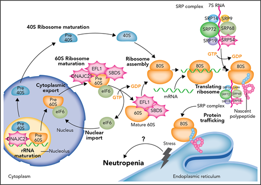 Defects in the proteostasis pathway lead to inherited neutropenia. Molecular cloning of genetic lesions in individuals with moderate to severe neutropenias have centered on the biosynthetic pathway for proteins and their folding and trafficking (proteostasis for protein homeostasis). The most common genetic lesion in SDS is the biallelic mutation of SBDS. SBDS interacts with EFL1 to displace eukaryotic initiation factor 6 (eIF6). DNAJC21 stabilizes the 60S ribosome. As part of the SRP complex, SRP54 escorts the nascent polypeptide to the ER to complete translation and possible posttranslational modification. When defects arise in this prodigious and continuous process, unfolded protein response and ER stress follows. The most commonly mutated gene in SCN is ELANE, which encodes a serine protease. It is thought that mutated ELANE results in proteins that misfold and cause unfolded protein response. Through unknown mechanisms of apoptosis and/or differentiation impairment, granulopoiesis cannot be completed in SCN or sufficiently produced in SDS. How SCN and SDS transform frequently to MD or AML remains inadequately understood. GDP, guanosine diphosphate; GTP, guanosine triphosphate. Professional illustration by Somersault18:24.