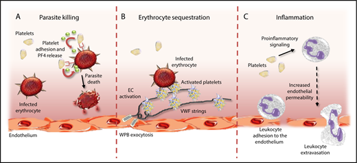 Platelets have multifactorial roles in malaria pathogenesis. Platelets can directly impact malaria pathogenesis through a number of different mechanisms. First, platelets can protect against malaria progression by binding to IEs and inducing Plasmodium killing through release of PF4 (A). In contrast, platelets tethered to ultralarge VWF strings secreted from activated ECs can promote cytoadhesion and sequestration of IEs, thereby promoting vascular occlusion (B). Finally, platelets can further promote malaria progression by driving proinflammatory effects directly, and by activating circulating leukocytes (C). WPB, Weibel-Palade body.