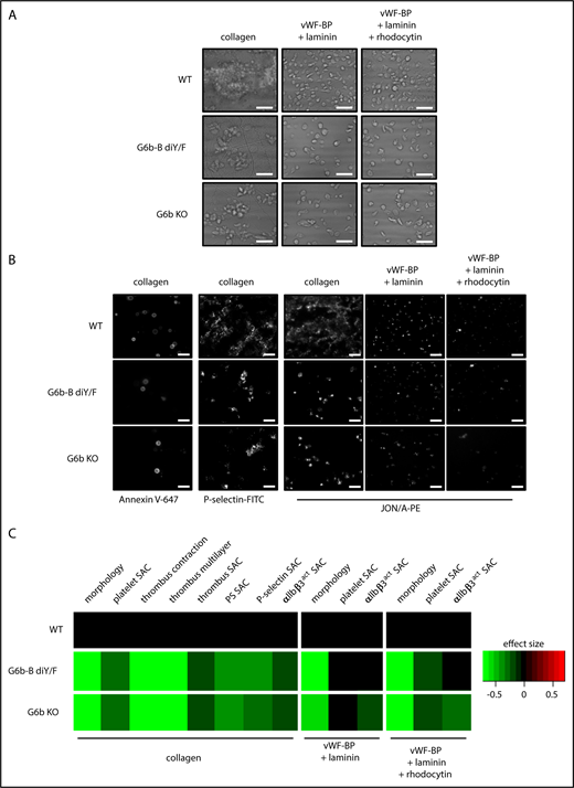 Figure 5. Reduced platelet adhesion and activation under flow conditions. PPACK, heparin, and fragmin anticoagulated whole blood from WT, G6b-B diY/F and G6b KO mice was flowed for 3.5 minutes (1000 s−1 shear) over coverslips coated with collagen, vWF-BP + laminin, and vWF-BP + laminin + rhodocytin. Representative brightfield images (A) and representative fluorescence images (B) following staining with Alexa Fluor 647–conjugated annexin V, P-selectin–FITC, and JON/A-PE antibodies to measure phosphatidylserine-positive platelets, α-granule release, and αIIbβ3 integrin activation (αIIbβ3act), respectively (scale bars, 10 μm). (C) Heat map showing the effect size of morphology scores and surface area coverage (SAC) of the indicated parameters, normalized to WT (n = 5 or 6).
