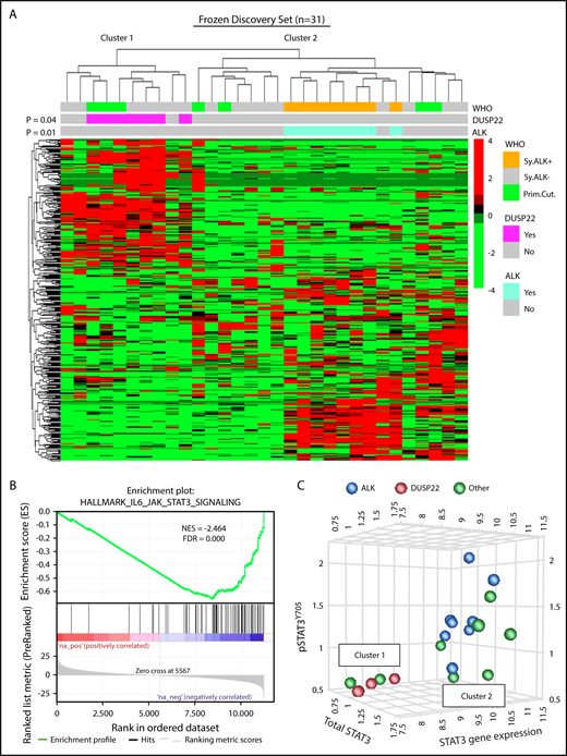 Figure 1. ALCLs with DUSP22 rearrangements belong to a unique cluster of ALCLs. (A) Unsupervised hierarchical clustering of gene expression data from 31 frozen ALCL samples shows that DUSP22-rearranged ALCLs segregate independently from ALK-positive ALCLs and are entirely contained within 1 of 2 main clusters (cluster 1). Genes shown were selected on the basis of coefficient of variation of at least 50% and expression in at least 4 samples across the entire data set, agnostic to subtype or cluster. P values reflect the probability that cases of similar type cluster together (Fisher exact test). WHO, WHO subtype. Primary cutaneous (Prim.Cut.) ALCLs did not cluster together significantly (P = .29). (B) Cluster 1 containing all DUSP22-rearranged ALCLs shows depletion of IL-6-JAK-STAT3-associated genes. (C) ALCLs in cluster 1 with low STAT3 gene expression also show low total STAT3 protein and low pSTAT3Y705 by reverse phase protein array. Genetic subtypes (ALK, DUSP22, or other ALK-negative) are indicated. The 3 cases indicated with DUSP22 rearrangements were systemic ALK-negative ALCLs and correspond to cases 1, 10, and 29 in supplemental Table 2.