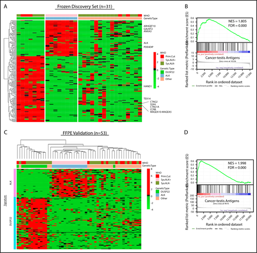 Figure 3. ALCLs with DUSP22 rearrangements overexpress CTA genes. (A) Affymetrix microarray analysis of 31 ALCLs in the frozen discovery set shows that DUSP22-rearranged ALCLs have a unique set of overexpressed genes, including multiple CTA genes and other genes regulated by methylation such as HAND1. WHO, WHO subtype. (B) CTA genes are significantly enriched in cases with DUSP22 rearrangements by GSEA. (C) Analysis of FFPE RNAseq gene expression data from an independent set of 53 ALCLs validates the DUSP22 and ALK molecular signatures shown in A. DUSP22 cases clustered together significantly (P = .0014), as did ALK cases (P < .0001). (D) GSEA of FFPE RNAseq data validates the enrichment of CTA genes in cases with DUSP22 rearrangements.
