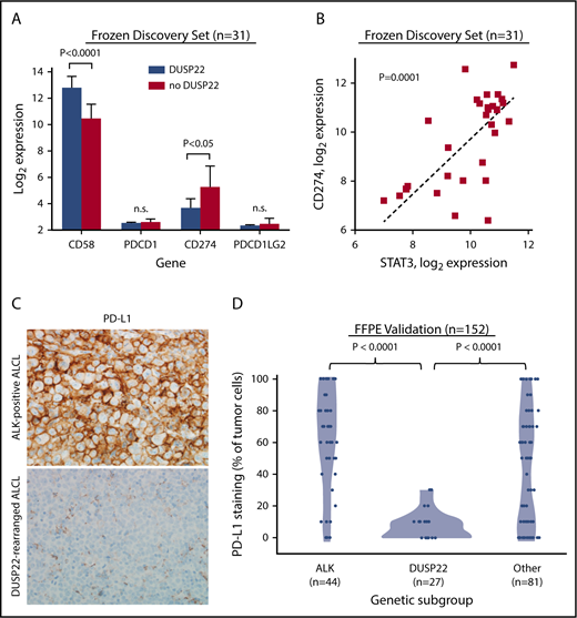 Figure 6. ALCLs with DUSP22 rearrangements show diminished expression of PD-L1 and overexpress CD58. (A) DUSP22-rearranged ALCLs show reduced expression of CD274 (encoding PD-L1) and increased expression of the costimulatory gene CD58. Significant differences in expression of PDCD1 (encoding PD-1) or PDCD1LG2 (encoding PD-L2) were not observed. P values, Wilcoxon test; n.s., not significant. (B) CD274 gene expression correlates with STAT3 gene expression in ALCL. Spearman ρ = 0.63; P = .0001. (C) Immunohistochemistry for PD-L1 in ALK-positive ALCL and DUSP22-rearranged ALCL. Original magnification, ×400. (D) DUSP22-rearranged ALCLs show significantly less tumoral staining for PD-L1 protein than either ALK-positive ALCL or other ALK-negative ALCLs (Wilcoxon test).