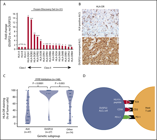 Figure 7. ALCLs with DUSP22 rearrangements express major histocompatibility complex class II. (A) DUSP22-rearranged ALCLs show increased expression of class II but not class I HLA genes. *P < .05; **P < .01; ***P < .001; ****P < .0001; n.s., not significant (Wilcoxon test). (B) Immunohistochemistry for HLA-DR in ALCLs with and without DUSP22 rearrangements. Original magnification, ×400. (C) DUSP22-rearranged ALCLs show significantly more tumoral staining for HLA-DR than either ALK-positive ALCL or other ALK-negative ALCLs (Wilcoxon test). (D) Model of immunogenic cues from DUSP22-rearranged ALCL cells and expected interactions with host reactive T cells. Red indicates upregulated molecules; green indicates downregulated molecules.