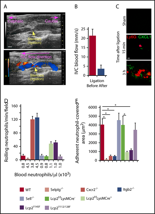 Figure 1. Cooperative PSGL-1 and CXCR2 signaling in neutrophils enhances adhesion in flow-restricted IVC. (A) Top, Sagittal view of B-mode ultrasonography confirms stenosis of the IVC after ligation. The cephalic and caudal directions are marked. Bar, 1 mm. Bottom, Color Doppler mode in B-mode sagittal view reveals the flow direction in the IVC around the stenosis. The blue color indicates blood flowing toward the transducer, from right (caudal) to left (cephalic). The red color indicates blood flowing away from the transducer, from left (cephalic) to right (caudal). (B) Blood flow in the IVC was quantified by pulse Doppler mode before and after ligation. (C) Representative images of CXCL1 expression (green) and adherent Ly6G+ neutrophils (red) in the IVC of WT mice obtained with spinning-disk intravital microscopy. PE-conjugated anti-Ly6G mAb and Fluoresbrite green beads coated with anti-CXCL1 mAb were injected IV into WT mice 1 hour before sham surgery or surgical ligation. Top, Three hours after sham surgery; middle, 15 minutes after ligation; bottom, 3 hours after ligation. Bar, 10 μm. (D) Number of rolling neutrophils per minute per microscopic field 3 hours after ligation (vertical axis). Circulating neutrophil count for each genotype (horizontal axis). (E) Quantification of endothelial surface area covered with firmly adherent neutrophils 3 hours after ligation. The data in the graphs represent the mean ± standard error of the mean (SEM) from 5 mice in each group. *P < .05.