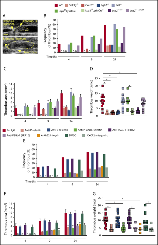 Figure 4. Cooperative PSGL-1 and CXCR2 signaling in neutrophils promotes DVT. (A) Representative thrombi scanned by ultrasonography. Thrombus areas: top, 3.1 mm2; bottom, 11.6 mm2. Bar, 1 mm. (B-C) Kinetics of thrombus development (frequency) and thrombus size (area) in mice of the indicated genotype, measured by ultrasonography at the indicated times after ligation. (D) Thrombus weight in the indicated genotype 24 hours after ligation. Each symbol represents an individual thrombus. Horizontal black bars represent median values. (E-F) Kinetics of thrombus development (frequency) and thrombus size (area) in mice with the indicated treatment, measured by ultrasonography at the indicated times after ligation. (G) Thrombus weight with the indicated treatment 24 hours after ligation. Each symbol represents an individual thrombus. Horizontal black bars represent median values. The data in panels B and E were taken from 10 to 18 mice in each group. The data in panels C and F represent the mean ± SEM from 3 to 14 mice in each group. *P < .05.
