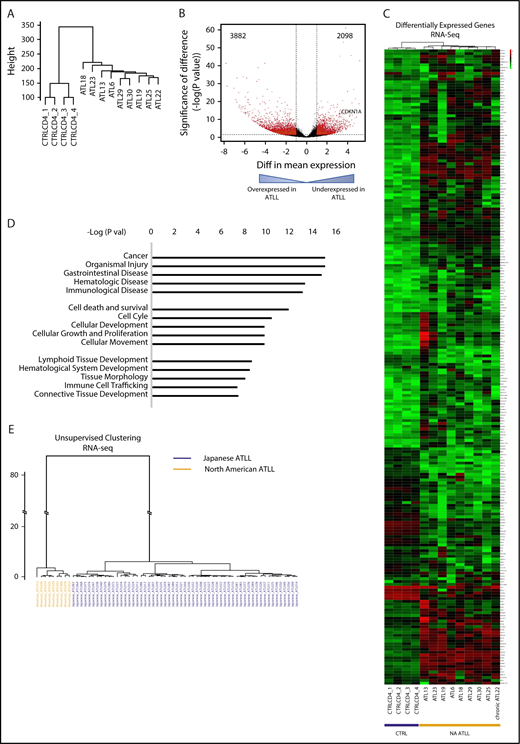 Figure 3. Distinct transcriptomic features are seen in North American ATLL. (A) Unsupervised clustering analysis of RNA-seq profiles of healthy CD4 controls and ATLL samples. (B) Volcano plot shows aberrantly expressed genes in North American ATLL compared with healthy controls. (C) Supervised clustering analysis reveals genes that are aberrantly expressed in North American ATLL. (D) Functional pathways enriched in differentially expressed genes. (E) Unsupervised clustering based on RNA-seq profiles shows transcriptomic differences between Japanese (blue, n = 57) and North American (orange, n = 9) ATLL samples.