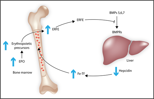 Model of the inhibition of hepcidin production by BMP6. Increased EPO expression leads to an expansion of erythroid precursors, which secrete ERFE, a hormone that circulates in the blood and that blocks the binding of BMPs 5, 6, and 7 to their BMP receptors. The decrease in BMP signaling in the liver leads to lower hepcidin production. Hepcidin negatively regulates the efflux of iron into the blood by downregulation of ferroportin. The lower hepcidin levels increase iron-bound Tf in the blood to promote the iron uptake of erythropoietic precursors to satisfy their needs for heme synthesis. BMPRs, BMP receptors; Fe-Tf, iron-loaded transferrin.