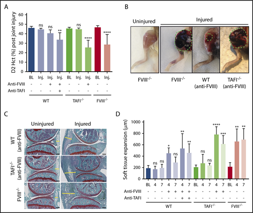 Figure 3. TAFI deficiency eliminates protection against joint bleeding in aHA mice. (A) Joint bleeding after knee injury in FVIII−/− BALB/c, WT C57Bl/6J, or TAFI−/− C57Bl/6J mice with or without anti-FVIII antibody (0.25 mg/kg) alone or in combination with anti-TAFI antibody MA-RT36A3F5 (7.5 mg/kg; n = 10-16). Bleeding was determined by measuring Hct at day 2 (D2) postinjury. (B) Photographs of the hematoma formed in the right injured knee at day 4 after injury in a FVIII−/− BALB/c mouse or an anti-FVIII antibody–treated WT-C57Bl/6J or TAFI−/− C57Bl/6J mouse. (C) Representative images of Safranin-O fast green staining of the left uninjured knee joint and corresponding right injured knee joint harvested at day 7 postinjury of a WT C57Bl/6J or TAFI−/− C57Bl/6J mouse injected with anti-FVIII antibody (0.25 mg/kg) or of a FVIII−/− BALB/c mouse. The yellow line indicates soft tissue expansion between the anterior meniscus and joint capsule. Original magnification, ×4; scale bar = 200 µm. (D) Soft tissue expansion (µm) at baseline (BL) and days 4 and 7 postinjury in WT C57Bl/6J, TAFI−/− C57Bl/6J, and FVIII−/− BALB/c mice with and without anti-FVIII antibody (0.25 mg/kg) and/or anti-TAFI antibody (MA-RT36A3F5; 7.5 mg/kg; n = 4-6). Soft tissue expansion was measured as the distance between the anterior meniscus and joint capsule (indicated by the yellow line in Figure 3C). BL indicates baseline without knee injury. Kruskal-Wallis test followed by Dunn’s post hoc multiple comparison test was used to compare experimental mice with their respective baseline controls. *P < .05, **P < .01, ***P < .001, ****P < .0001. ns, not significant.