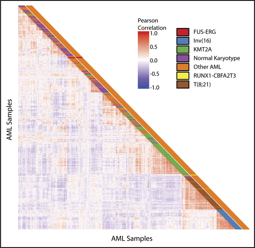 Figure 2. Unsupervised clustering analysis. Pairwise sample correlations of 1037 samples of pediatric AML. The cells in the visualization are colored by Pearson’s correlation coefficient values. Cytogenetic subgroups are depicted in the first column. Presence of FUS-ERG or RUNX1-CBFA2T3 is depicted in the second column.