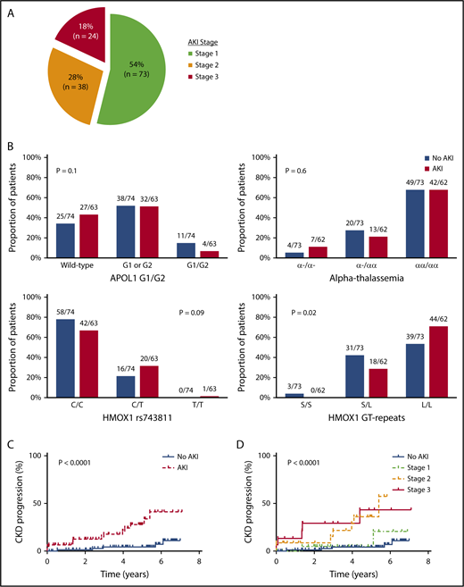 Figure 1. AKI in SCA. (A) Severity of AKI events among patients with SCA. AKI severity was stage 1 (serum creatinine rise 1.5-1.9 times baseline) in 73 of 135 (54%) AKI events, stage 2 (serum creatinine rise 2.0-2.9 times baseline) in 38 of 135 (28%) AKI events, and stage 3 (serum creatinine rise ≥3 times baseline, serum creatinine ≥4.0 mg/dL, or requiring hemodialysis) in 24 of 135 (18%) AKI events observed in patients with SCA during the follow-up period. (B) AKI risk by candidate gene variants. No association for AKI risk with APOL1 G1 and G2 risk variants or coinheritance of α-thalassemia was observed, whereas trends were observed for an association with HMOX1 rs743811 T risk allele and long GT tandem repeats in the promoter region of HMOX1. (C) CKD progression by AKI status. SCA patients with an AKI event (14/63, 22%) had more rapid CKD progression (defined as a 50% reduction in eGFR or requiring renal replacement therapy) compared with those without an AKI event (5/74, 7%). (D) CKD progression by AKI severity. Severity of AKI events was associated with more rapid progression of CKD in patients with SCA (stage 3: 5/15, 33%; stage 2: 7/22, 32%; stage 1: 2/26, 8%; no AKI: 5/74, 7%).