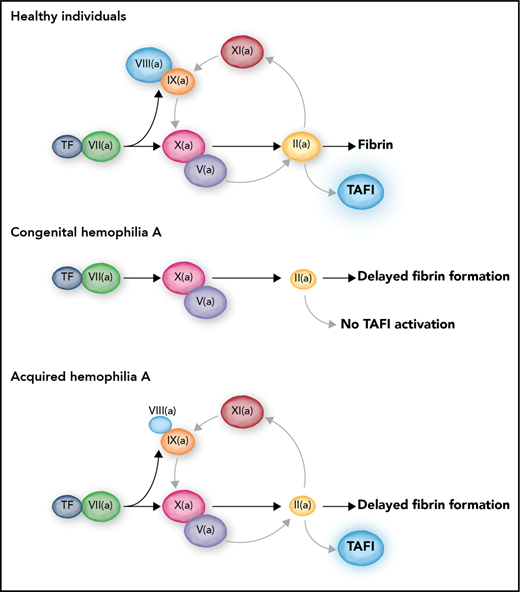 In healthy individuals, TF-induced coagulation provides rapid clot formation followed by a secondary burst of thrombin generation via FXI. This secondary thrombin burst facilitates TAFI activation, which results in protection of the clot against premature lysis. In severe congenital hemophilia, the complete absence of FVIII leads to a triple defect: a delayed clot formation, an absent FXI-mediated secondary thrombin burst, and a consequently absent activation of TAFI. In contrast, acquired hemophilia is only a single coagulation defect with delayed clot formation but preserved secondary thrombin generation and TAFI activation. Professional illustration by Somersault18:24.
