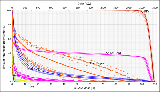 Figure 1. Robustness analysis based on DVHs showing multiple scenarios representative of different uncertainties and their resulting effect on the dose distribution for a specific organ at risk or target.