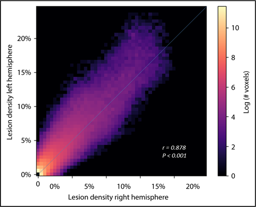 Figure 3. SCIs in pediatric SCA are symmetric. Voxel densities in the right hemisphere were plotted against mirror densities in the left hemisphere with number of voxels represented in the in-plane color axis. Correlation of right-left densities, calculated using Pearson’s r, demonstrates high symmetry of lesion density between the 2 hemispheres.