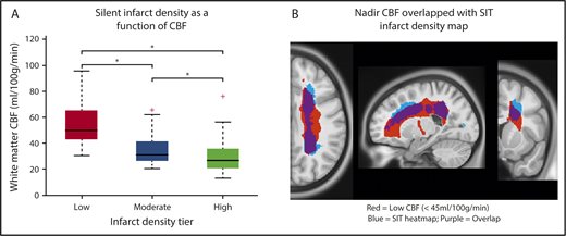 Figure 4. White matter cerebral blood flow is lowest in regions of highest infarct density. Resting cerebral blood flow maps from an independent cohort of children with SCA were aligned to the infarct density map of the SIT Trial participants. (A) Mean cerebral blood flow was measured within 3 regions of low, moderate, and high infarct density. White matter cerebral blood flow was lowest in the region of highest infarct density (Friedman Test, P < .001). *Pairwise tests for low- vs moderate-infarct-density, moderate- vs high-infarct-density, and low- vs high-infarct-density tiers, were significant after adjustment for multiple comparisons (P < .05). These data confirm that a nadir in resting cerebral blood flow may contribute to elevated and symmetric infarct densities in the border zone regions in pediatric SCA. (B) Nadir cerebral blood flow map (defined as average cerebral blood flow <45 mL/100 g/min) from the independent pediatric SCA cohort overlaid onto the infarct density map of the SIT Trial participants thresholded to include SCIs from 90% of the SIT Trial cohort. A high degree of overlap is found between nadir cerebral blood flow in the border zone region and regions of peak infarct density. CBF, cerebral blood flow.