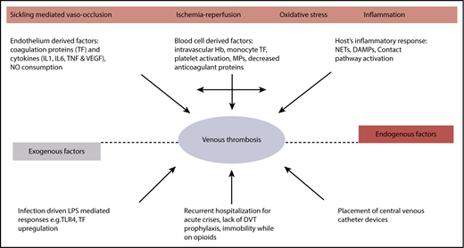 Figure 1. Hypercoagulability in SCD. DAMP, damage-associated molecular pattern; IL, interleukin; LPS, lipopolysaccharide; MP, microparticle; NET, neutrophil extracellular trap; TF, tissue factor; TLR, Toll-like receptor; TNF, tumor necrosis factor α; VEGF, vascular endothelial growth factor.