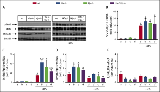 Figure 4. Livers of Hjv-deficient mice retain inflammatory Smad signaling, presumably via activin B. (A-E) Liver protein extracts and RNA from mice described in Figure 2 were used for western blotting and qPCR analysis, respectively. (A) Levels of pStat3, Stat3, pSmad5, and Smad5; (B) Socs3 mRNA; (C) Inhbb mRNA; (D) Bmp6 mRNA; (E) Id1 mRNA. All data are presented as the mean plus or minus SEM. Statistical analysis was performed by 2-way ANOVA. Statistically significant differences (P < .05) across genotypes (vs columns a, a′, b′) are indicated by a, a′, b′, and across LPS treatment by pound sign (#).