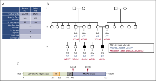 Figure 1. Identification of a homozygous missense substitution in GNE. (A) Filtering strategy of whole-exome sequencing results to identify candidate variants in patients III:3 and III:5 of the same family. (B) Segregation analysis of the exome candidates in family members where DNA was available. The 3 variants (in the genes GNE, FRMPD1, and ANKRD18A) were shared by both affected children and were located within a region of homozygosity on chromosome 9p13.3. Double lines linking parents signify first-cousin unions. (C) Linear domain organization of GNE encoding the enzyme UDP-GlcNAc 2-epimerase/ManNAc kinase. Experimental allosteric sites are based on in vitro studies (AS), region of unknown function (UF). The approximate position of amino acid substitutions (p.G416R and p.G559R) found in the family in this study and in an independent study,11 respectively, are indicated and based on transcript NM_005476. del, deletion; WT, wild-type.