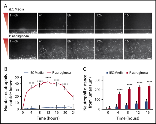 Figure 2. P aeruginosa induces neutrophil extravasation and migration. Neutrophils migrate significantly more to a source of P aeruginosa compared with iEC media alone. (A) Representative images of neutrophils migrating at 4-hour intervals. Neutrophils stained with calcein AM. Gradient direction shown in red. White line indicates the edge of the endothelial lumen. Scale bar, 100 µm. (B) The number of neutrophils outside the lumen was counted at 1-hour intervals, using particle analysis in FIJI. (C) The distance from the lumen edge was measured for all in-focus neutrophils outside the lumen at 4-hour intervals. Each bar represents the mean plus standard error of the mean (SEM). (B-C) Data quantified from 9 lumens per condition across 3 independent experiments. Asterisks represents significance between conditions at each point. ****P < .0001.