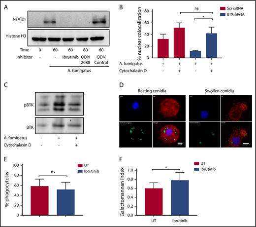 Figure 2. Endosomally driven Btk responses during human macrophage infection with A fumigatus are required for optimal fungal growth control. (A) TLR9 engagement and BTK phosphorylation are required for NFAT activation in response to A fumigatus in hMDMS. hMDMs were pretreated with Ibrutinib (1 µM), the TLR9-blocking nucleotide ODN2088 (10 µM), or ODN nucleotide control (10 µM) for 1 hour. Macrophages were then infected with A fumigatus swollen conidia (MOI = 1) for 1 hour. Whole cell lysates were separated by SDS-PAGE, followed by western blotting. Membranes were probed with anti-NFATc1 and Histone H3 antibodies. (B-C) BTK mediates an endosomal NF-ĸB activation pathway in human macrophages. (B) Monocyte-derived macrophages were pretreated with Scramble or BTK-targeting siRNA (100 nM) for 72 hours and additionally with cytochalasin D (10 µM) or vehicle. Macrophages were stimulated with eGFP A fumigatus swollen conidia (MOI = 1) for 1 hour, and NFATc1 and NFKB translocation were measured by confocal microscopy. Nuclear translocation was quantified by calculating the percent overlap of the nuclear DAPI and transcription factor–linked fluorophore channels. Data were calculated from 7 fields of view taken at random per biological repeat. Mean and standard deviation of 3 biological repeats are represented. (C) Whole cell lysates were separated by SDS-PAGE, followed by western blotting. Membranes were probed with anti-BTK and anti–β-actin antibodies. Statistical analysis was performed using paired Student t tests: ns, not significant; *P < .05; NS, nonstimulated. (D) BTK is recruited to the membranes of endosomes containing swollen but not resting conidia in hMDMs. Representative confocal microscopy of monocyte-derived macrophages infected with eGFP expressing A fumigatus (green) (MOI = 1) at 45 minutes propidium iodide stained for BTK (red) and nuclei (blue) (original magnification ×60). (a) Nuclei; (b) BTK; (c) eGFP; (d) composite images. (E) Ibrutinib does not block A fumigatus phagocytosis. Monocyte-derived macrophages were pretreated with Ibrutinib (1 µM) for 1 hour. Macrophages were infected with biotinylated A fumigatus-GFP (green fluorescent protein) swollen conidia (MOI = 1) for 2 hours. External conidia were then counterstained with Cy3 biotin antibody, and phagocytosis was measured by flow cytometry. (F) Ibrutinib impairs macrophage control of fungal growth in vitro. Monocyte-derived macrophages were pretreated with Ibrutinib (1 µM) for 1 hour. Cells were stimulated with A fumigatus swollen conidia (MOI = 1) for 6 hours. Galactomannan levels were measured in the tissue culture supernatants. UT, untreated.