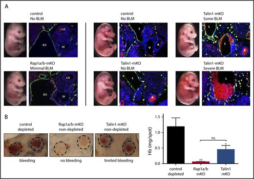 Figure 7. Platelet RAP1 signaling minimally contributes to the maintenance of vascular integrity during development and inflammation. (A) Contribution to vascular integrity during development was determined by assessing blood lymphatic mixing (BLM) in embryos at ∼E16.5 by macroscopic observation, using a Leica MZ16FA dissecting stereoscope, and immunofluorescence staining of embryo sections. Embryos were sectioned at the jugular lymph sac (JLS), and lymphatic endothelial cells (green) were stained with primary antibody overnight (polyclonal rabbit anti-mouse LYVE-1), followed by donkey anti-rabbit Alexa Fluor 488 and 4′,6-diamidino-2-phenylindole. Red blood cells were visualized by autofluorescence (red). Images were acquired on a Nikon E800 microscope with a Hamamatsu camera with MetaMorph software (Molecular Devices). (B) Contribution to vascular integrity at sites of inflammation was determined by rpA reaction in the skin of control (Pf4-Cre-) mice depleted of all circulating platelets (by intravenous injection of antibodies against GPIbα) compared with nondepleted Rap1a/b-mKO or nondepleted Talin1-mKO mice. Representative images of rpA sites are shown (dashed circles) (left panels). Hemorrhage at sites of inflammation was quantified by measuring hemoglobin (Hb) levels in skin lesions 4 hours after rpA challenge (n = 5-7) (right panel). *P < .05, **P < .01. ns, not significant.
